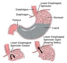 Why Stomach Acid is Digestive Dynamite